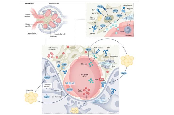 Anatomical and functional effects of obesity on the glomerulus.