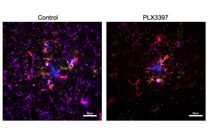 Side-by-side microscopic images compare brain tissue from a control sample and a PLX3397-treated sample. Fluorescent colors identify amyloid plaques, immune cells, and other cellular markers used to examine changes associated with Alzheimer’s disease.