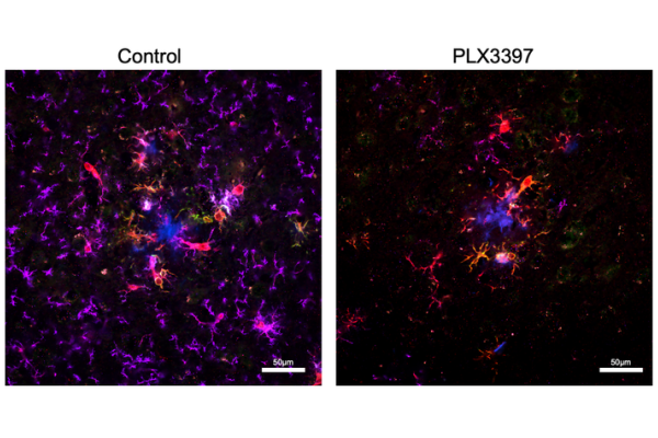 Side-by-side microscopic images compare brain tissue from a control sample and a PLX3397-treated sample. Fluorescent colors identify amyloid plaques, immune cells, and other cellular markers used to examine changes associated with Alzheimer’s disease.