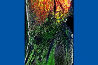 The cover of Journal of Neuroscience Vol. 45, Issue 1, published Jan 2025, featured this image of nerve fibers (green) trying to grow into spinal injury sites (white), while others (red) do not