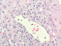 Liver cells