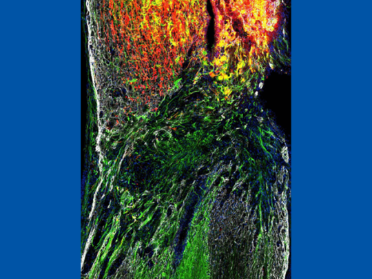 The cover of Journal of Neuroscience Vol. 45, Issue 1, published Jan 2025, featured this image of nerve fibers (green) trying to grow into spinal injury sites (white), while others (red) do not