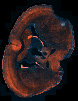 Microscope image of Astrocyte Nick D