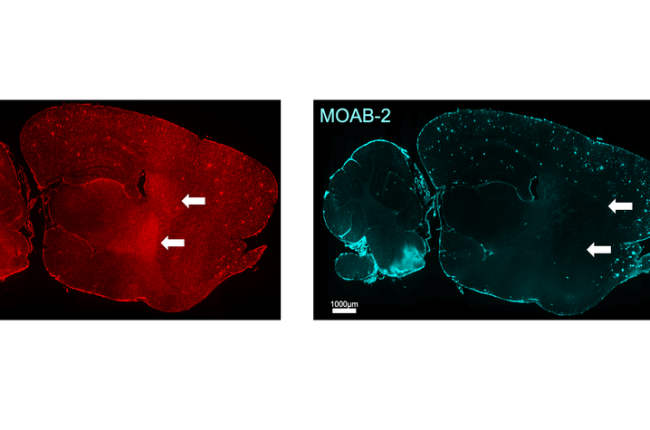 Scientific brain images showing fluorescent staining of brain tissue. Colored markers highlight immune cells and amyloid plaques, with arrows indicating regions of interest used to study Alzheimer’s disease-related changes in the brain.