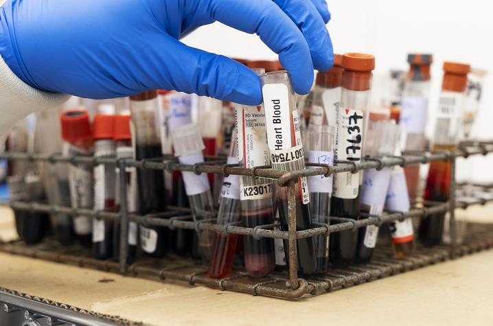 blood samples in a rack